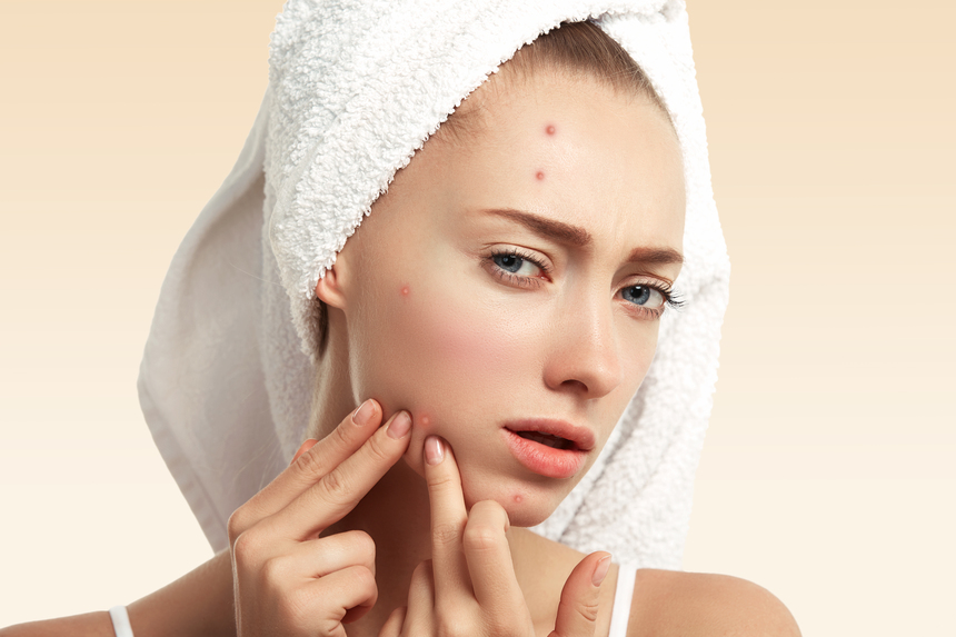 Pimples Treatment in Indira Nagar Nashik